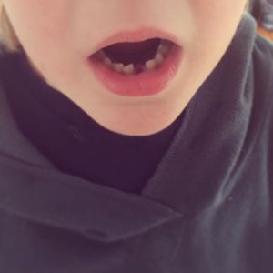 child with gap in tooth